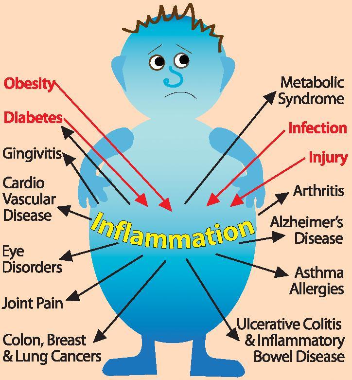 6 Foods That Cause Inflammation